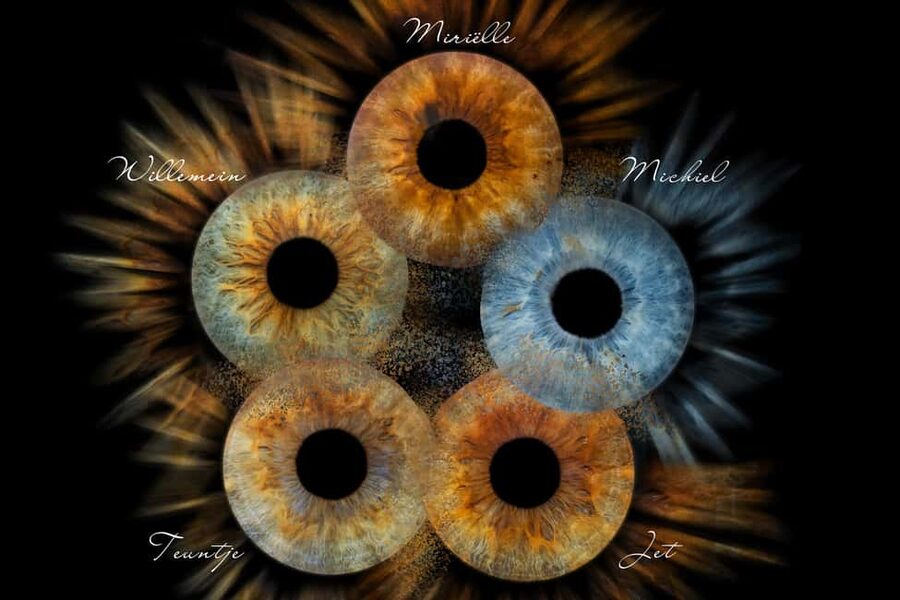 IRIS Photography (macro photo of your eye) - What Actually Happens During Your 10 Minutes