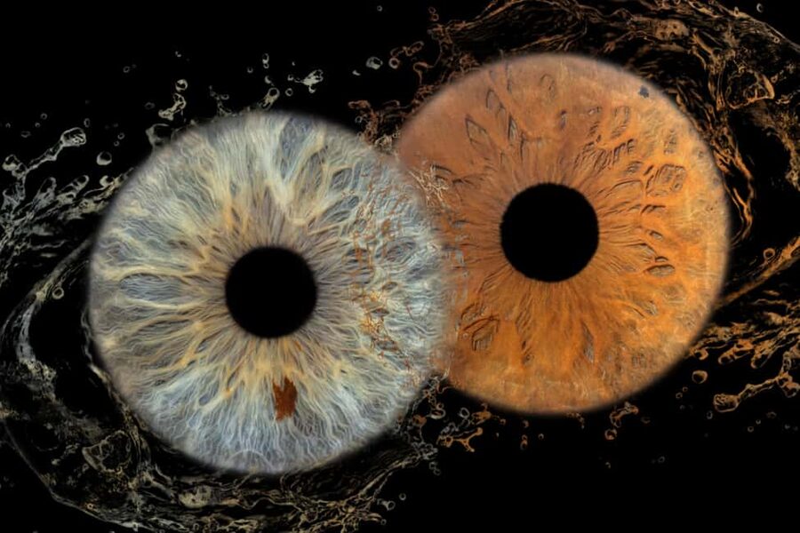 IRIS Photography (macro photo of your eye) - Getting to the Studio, Center of Split Convenience